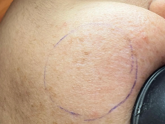 Untitled-1-Recovered-Recovered-Recovered-Recoveredsdfgerdf