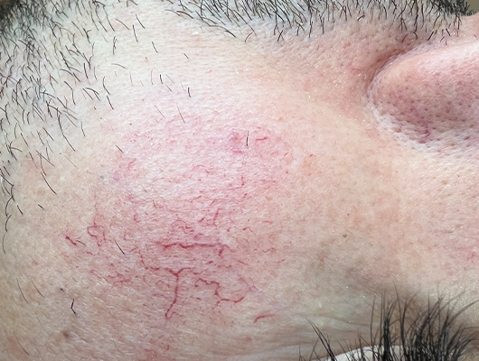 Untitled-1-Recovered-Recovereddaassdf