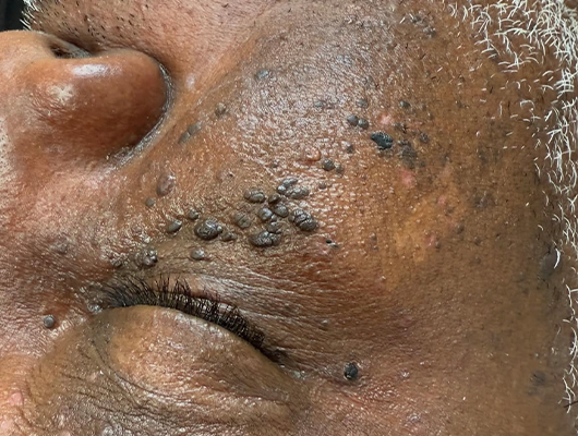 Untitled-1-Recoveredretd